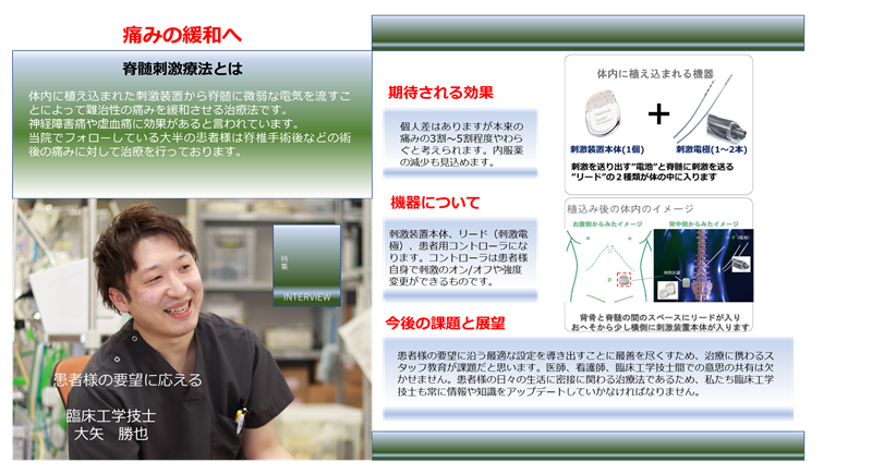 脊髄刺激療法とは TOP 2 R